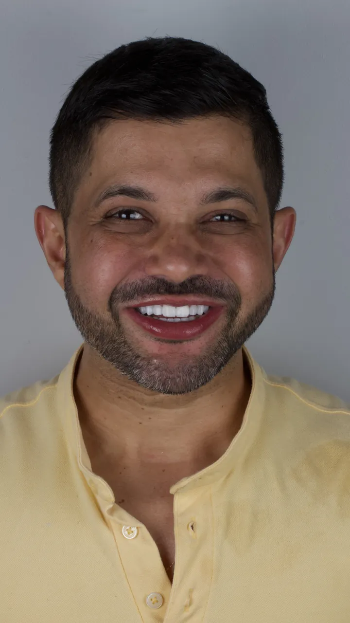 Paciente da Dra. Yasmin Resende